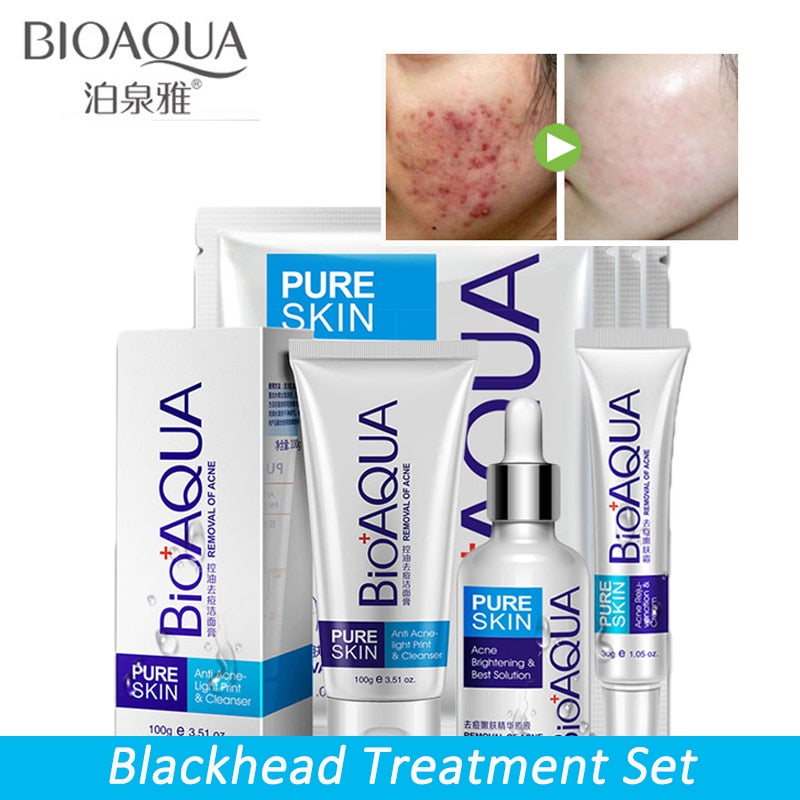 BIOAQUA Anti Acne Shrink Pores Whitening Treatment Blackhead Scars  Anti Acne Removal Gel  Moisturizing Scar Face Care Set 4 pcs